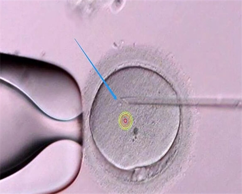 肇庆骗子助孕医院哪里比较好？附医院排名