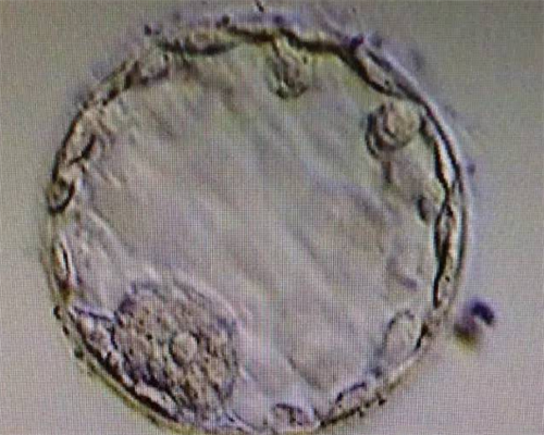 碧海代孕网_环球宝贝代孕合法吗,襄阳市哪个医院可以做第三代试管生小孩