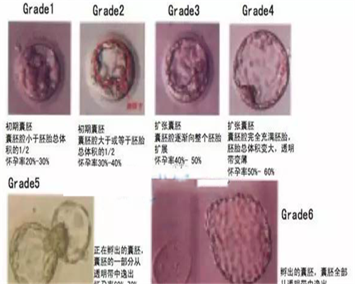 试管代孕详细案例,沧州正规试管助孕中心大全